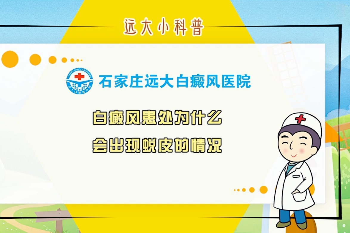 为什么会出现service